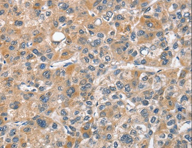 CHMP4B Antibody