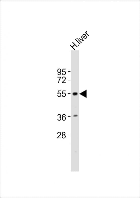 IA-6 / INSM2 Antibody (aa192-227)