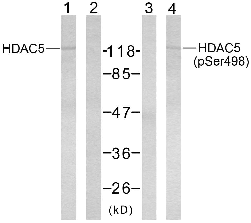 HDAC5 Antibody (phospho-Ser498)