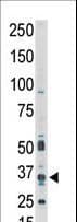 PIM1 / Pim-1 Antibody (aa374-404)