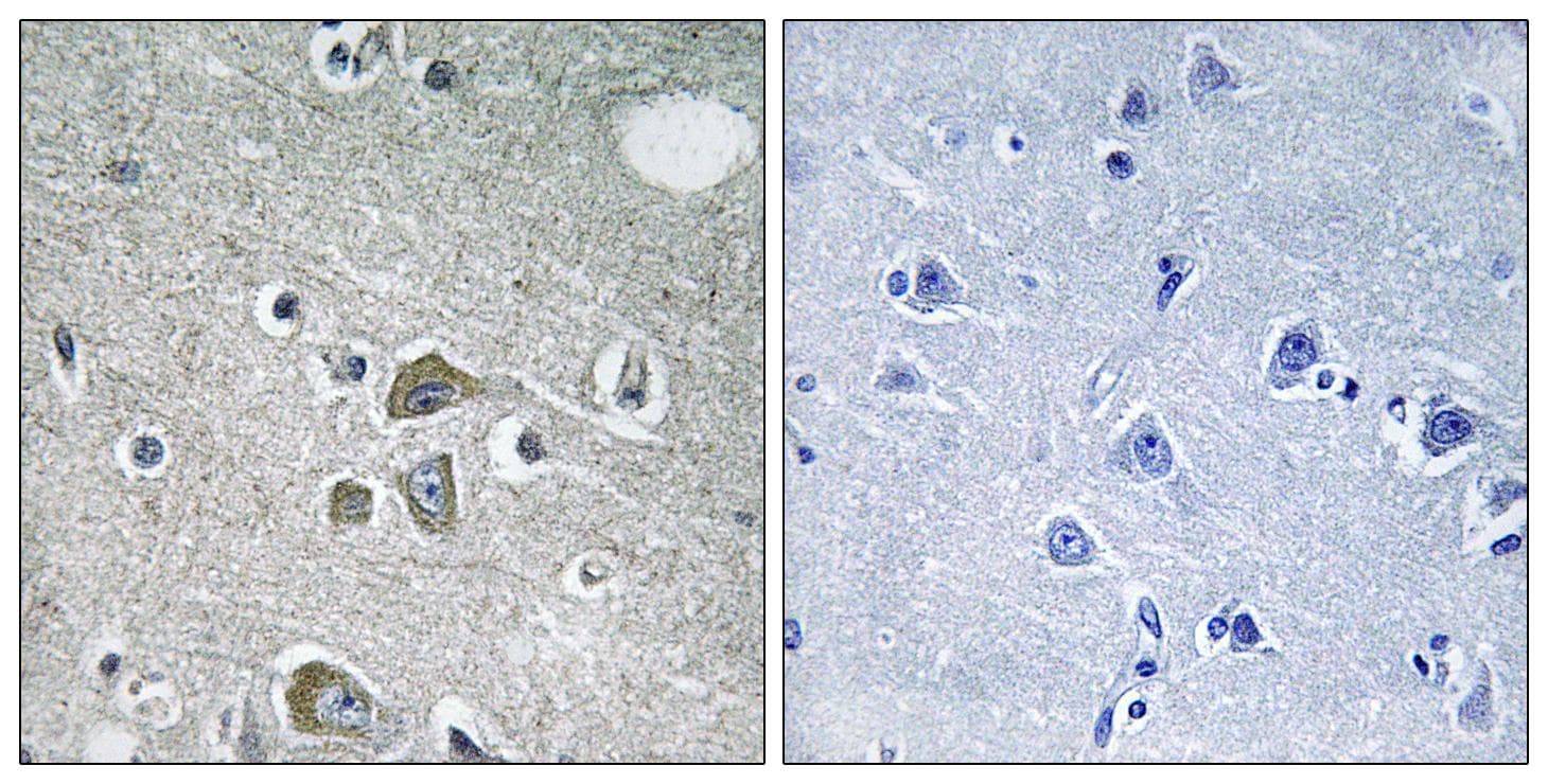Polyclonal Rabbit anti-Human FBLN2 / Fibulin 2 Antibody (IHC, IF)