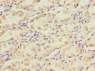 Polyclonal Rabbit anti-Human NT5C3A Antibody (IHC)