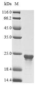 Cyanophora paradoxa dnaK Protein (Recombinant 10His, N-terminus + Myc, C-terminus)