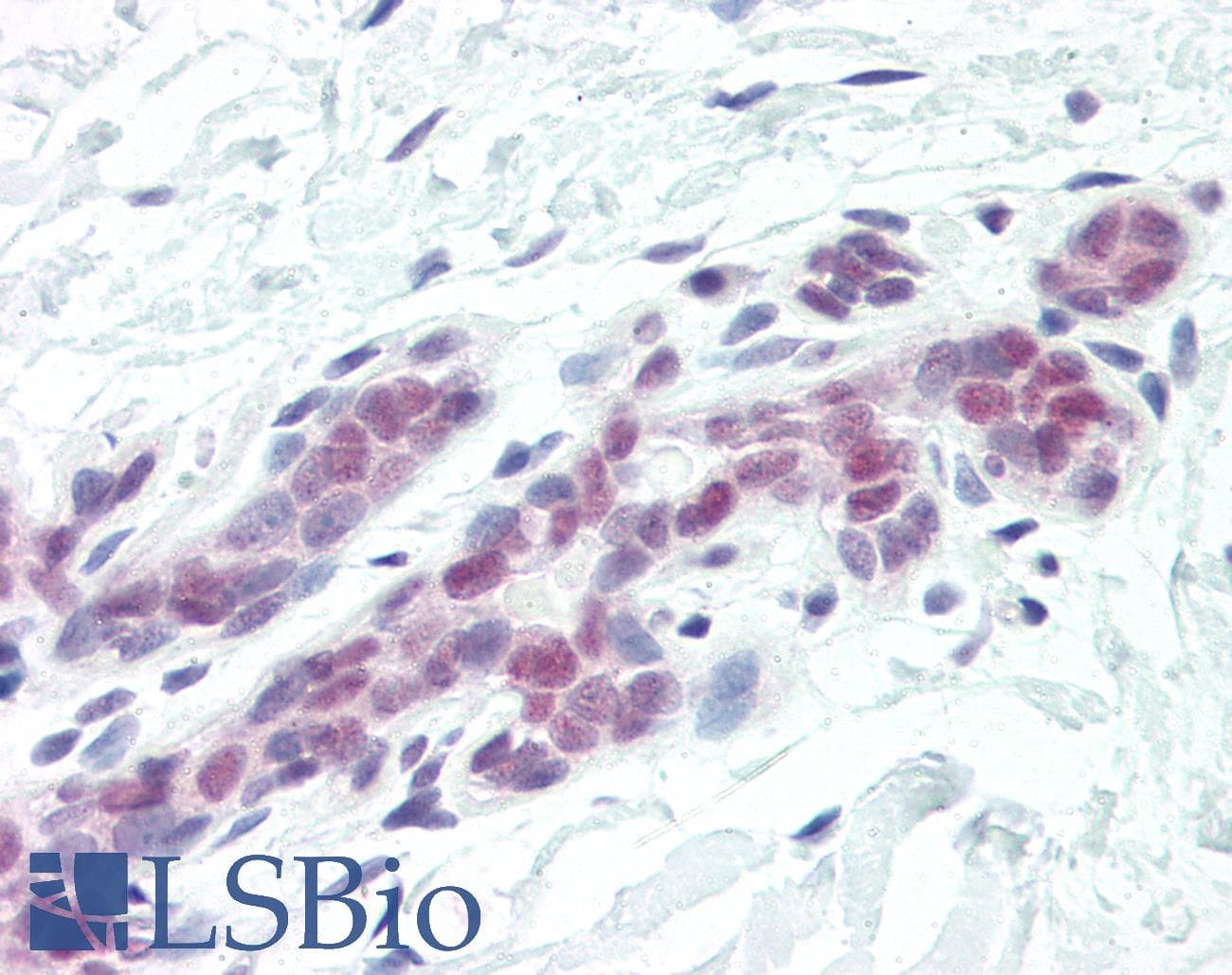 IHC-plus™ DFFA / ICAD / DFF45 Antibody