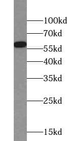 Monoclonal Mouse anti-Human PDI / P4HB Antibody (IHC, WB)