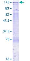 Human DNMT3A Protein (Recombinant GST)
