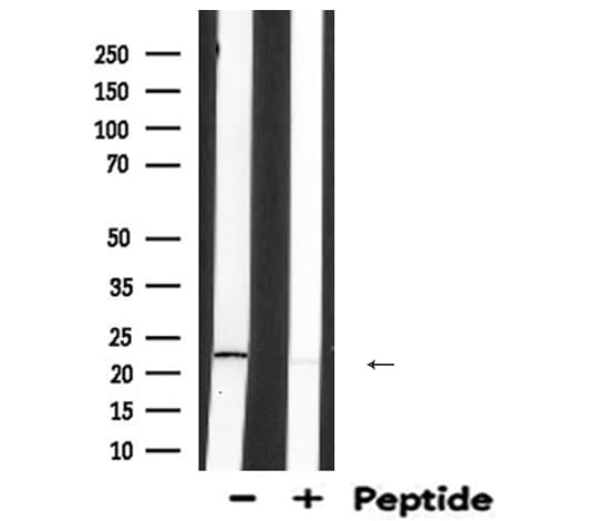Polyclonal Rabbit anti-Human TAGLN / Transgelin / SM22 Antibody (WB)