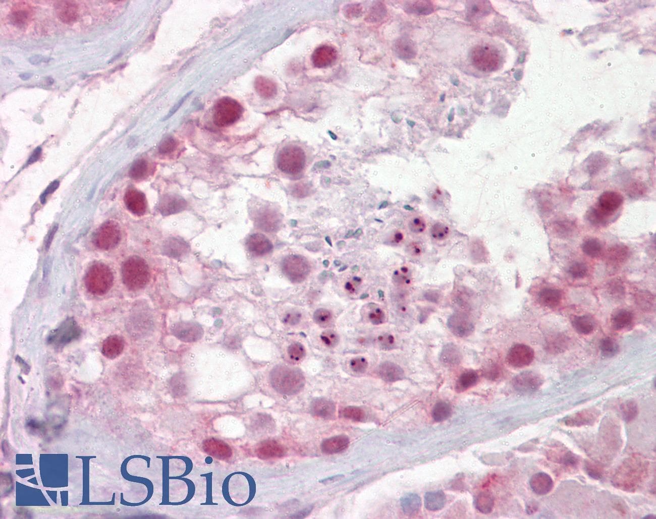 IHC-plus™ PES1 Antibody (aa2-14)