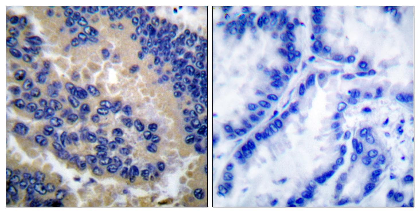 CASP3 / Caspase 3 Antibody (Cleaved-Asp175)