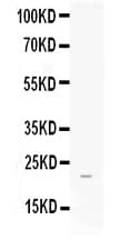 Polyclonal Rabbit anti-Human FGF21 Antibody (WB)