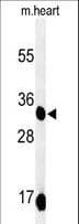 COQ9 Antibody (aa156-184)