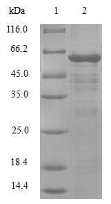 Human BCAP / PHF11 Protein (Recombinant GST, N-terminus)