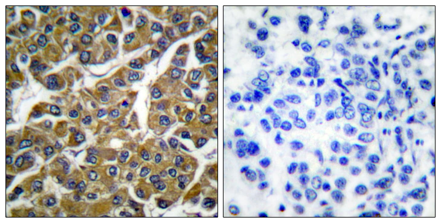 MMP3 Antibody (aa421-470)