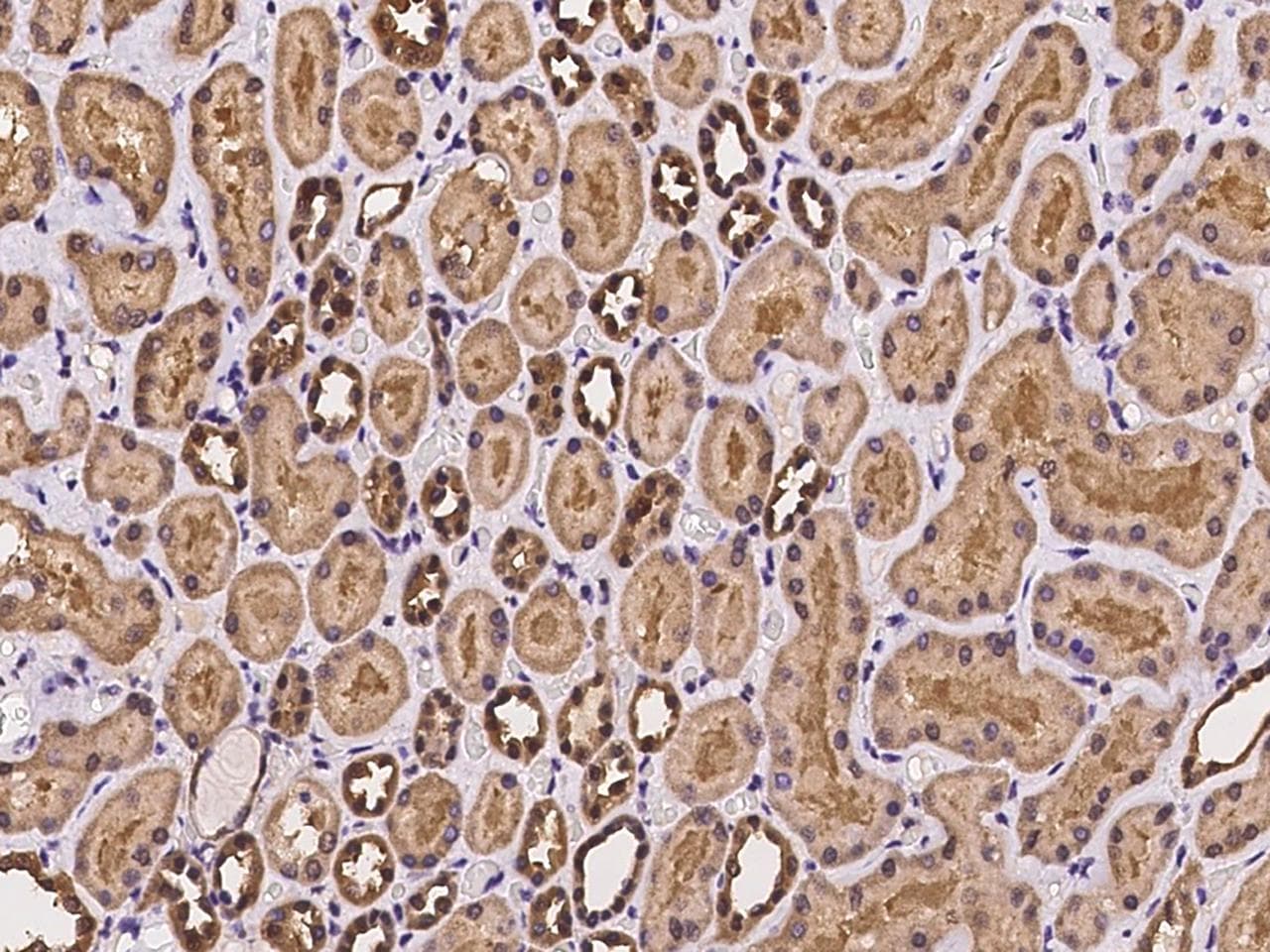 HDDC2 Antibody