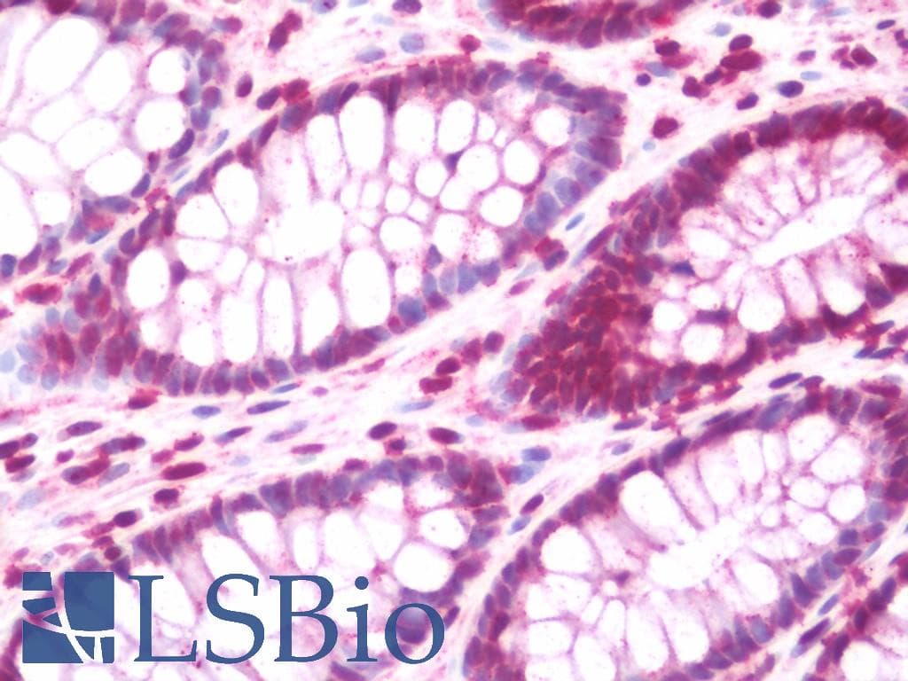 PathPlus™ Polyclonal Rabbit anti-Human FOXP1 Antibody (aa650-677, IHC, WB)