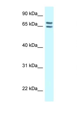 CNKSR1 Antibody (aa545-594)
