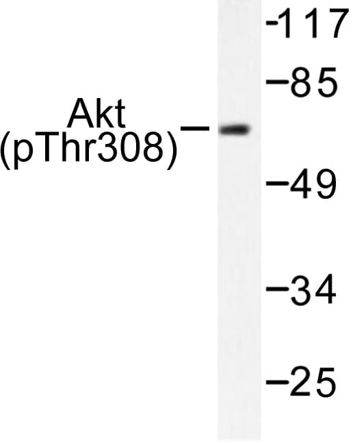 AKT1 + AKT2 + AKT3 Antibody (phospho-Thr308)