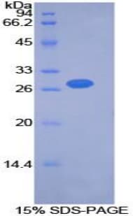 Mouse PDK2 Protein (Recombinant His-T7)