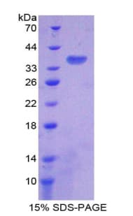 Rat ATP6AP2 / Renin Receptor Protein (Recombinant His-T7)