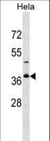 GOLPH3L Antibody (aa105-133)