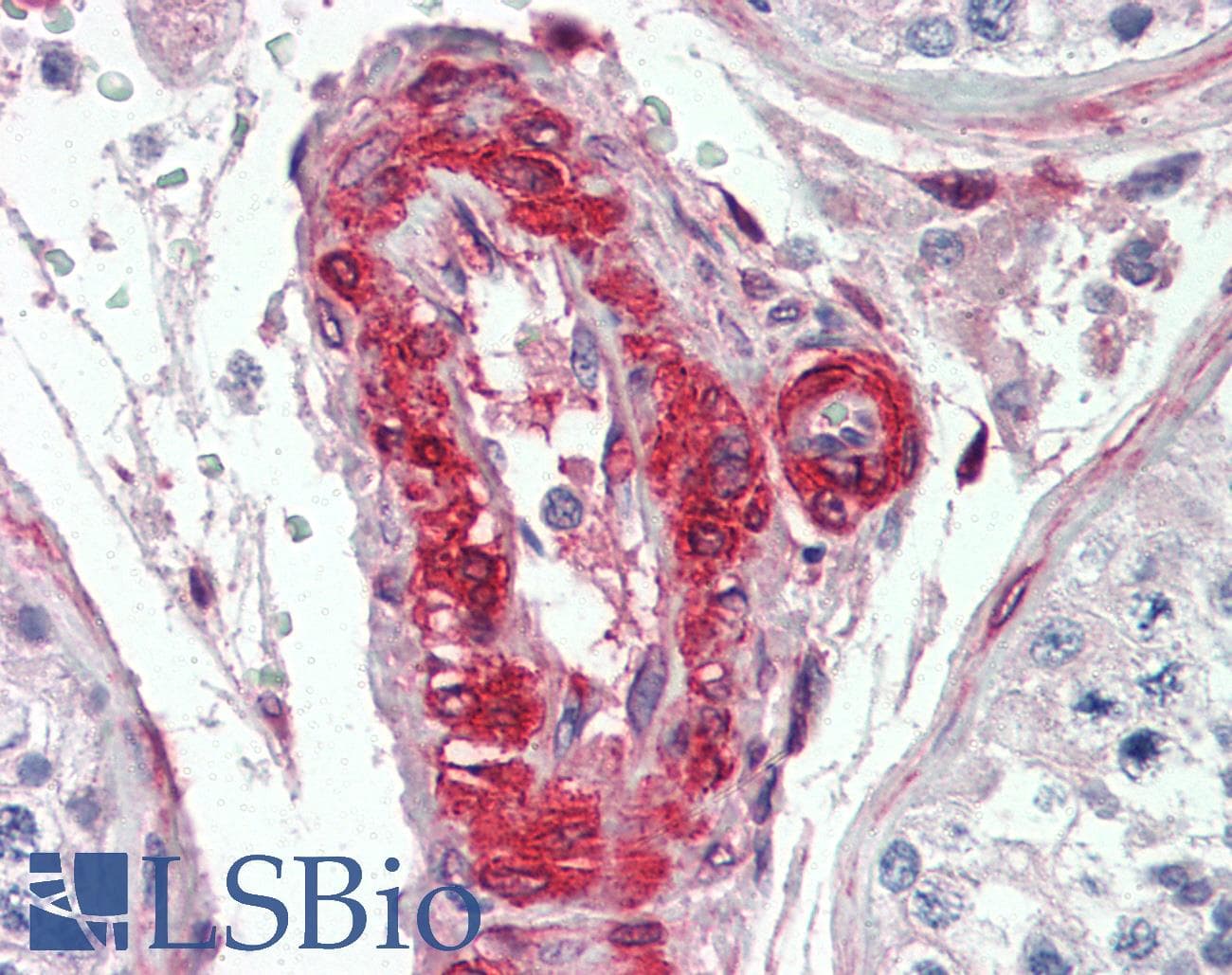 IHC-plus™ lpp Antibody (clone 8B3A11)