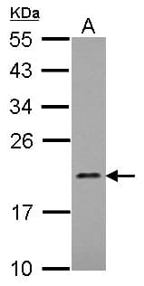 MRPL21 Antibody