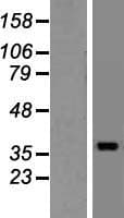 ELMOD1 Protein (Over-Expression Lysate Myc-DDK (Flag))