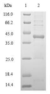 Human HLA-DRB1 Protein (Recombinant 10His-SUMO, N-terminus + Myc, C-terminus)