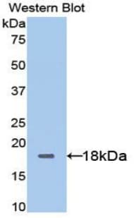 CD95 / FAS Antibody (aa26-173)