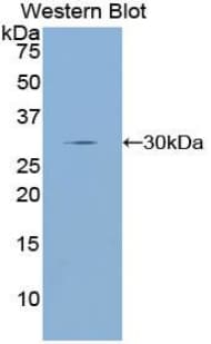 DRD2 / Dopamine Receptor D2 Antibody (aa194-421)