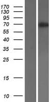 Human CD105 Protein (Over-Expression Lysate Myc-DDK (Flag))