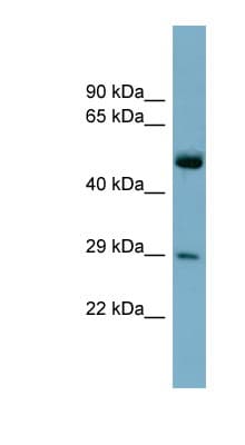 RAB27A / RAB27 Antibody (C-Terminus)