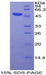 Human DVL3 / Dishevelled 3 Protein (Recombinant His-GST)