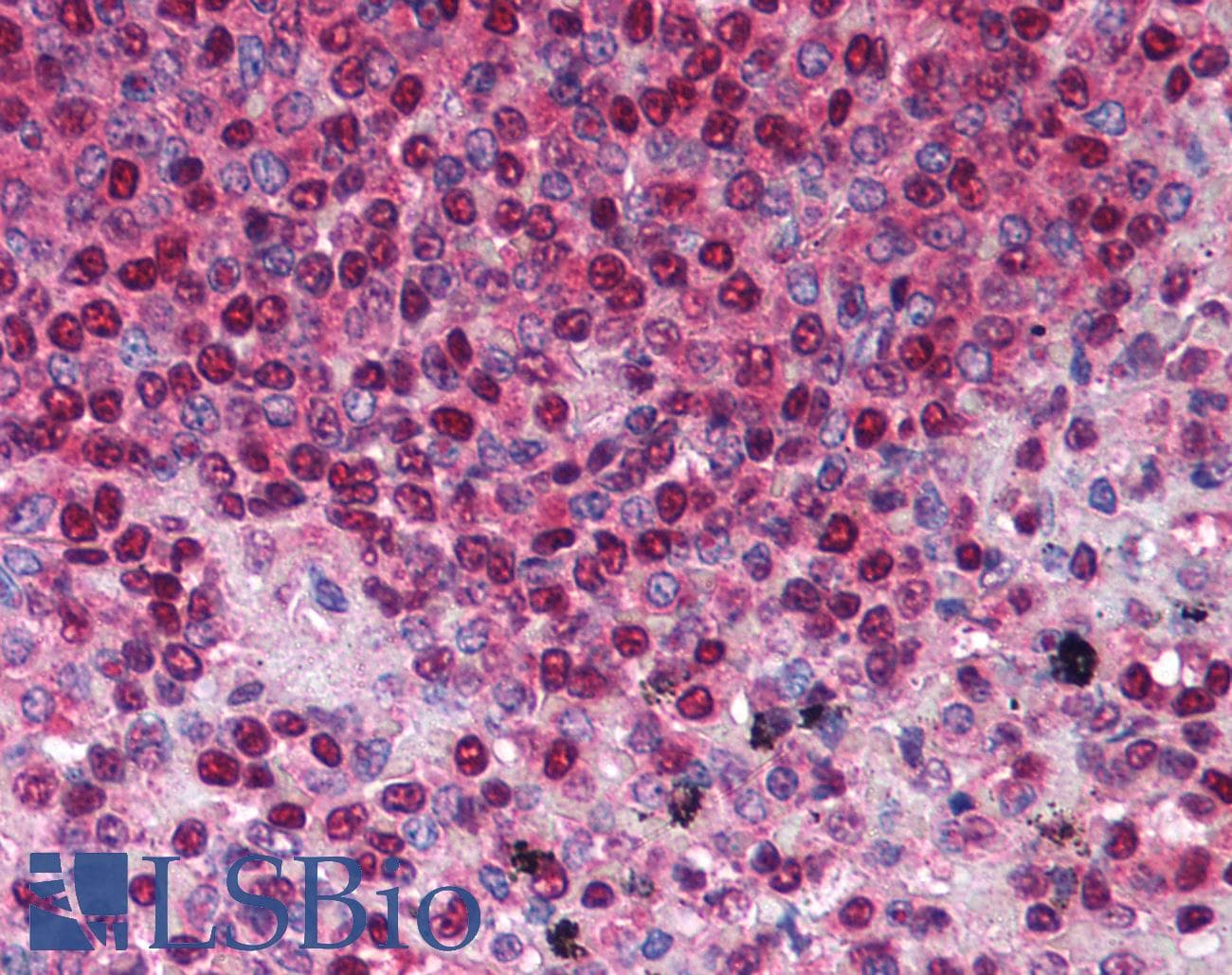 IHC-plus™ TNFRSF13B / TACI Antibody (aa116-132)