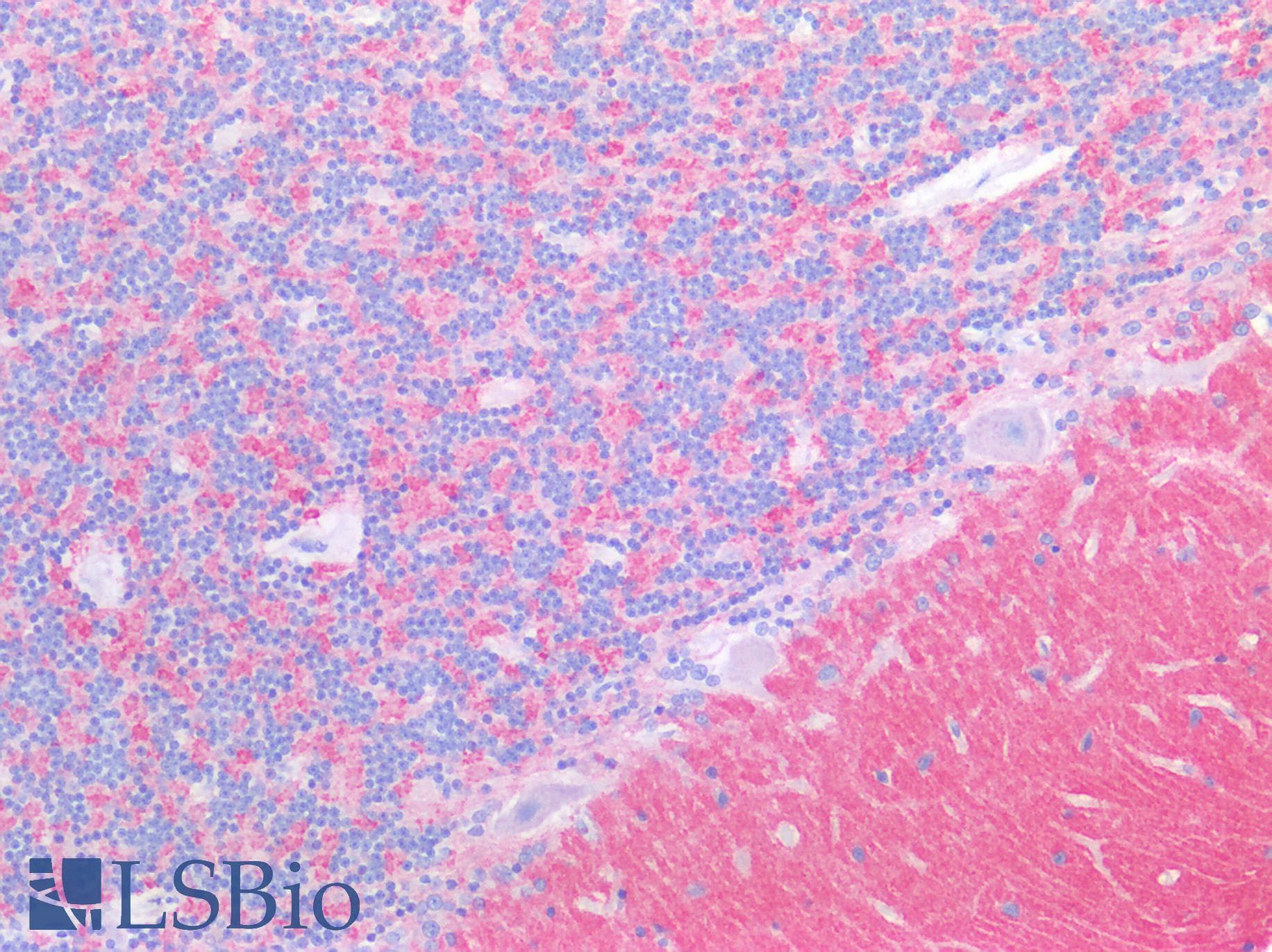 PathPlus™ Polyclonal Rabbit anti-Human SYT1 / Synaptotagmin Antibody (IHC, IF, WB)