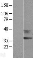 RDH12 / LCA3 Protein (Over-Expression Lysate Myc-DDK (Flag))