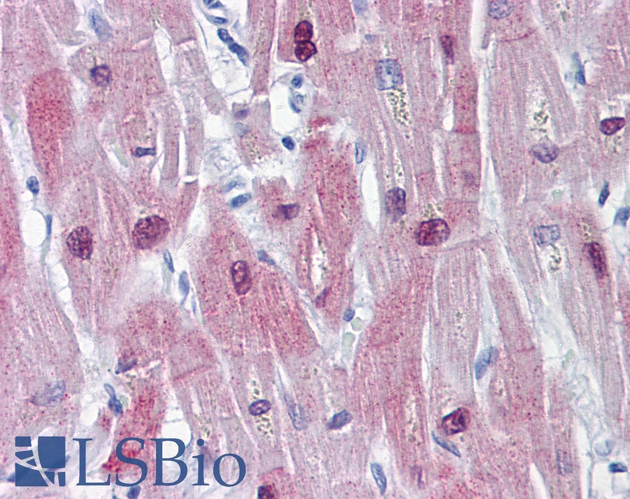 IHC-plus™ Monoclonal Mouse anti-Human HSPB6 / HSP20 Antibody (IHC, IF, WB)