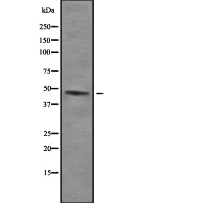 UBE1DC1 / UBA5 Antibody