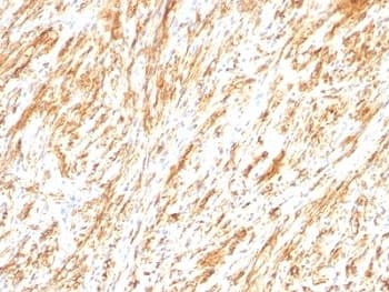 GFAP Antibody (clone SPM248)