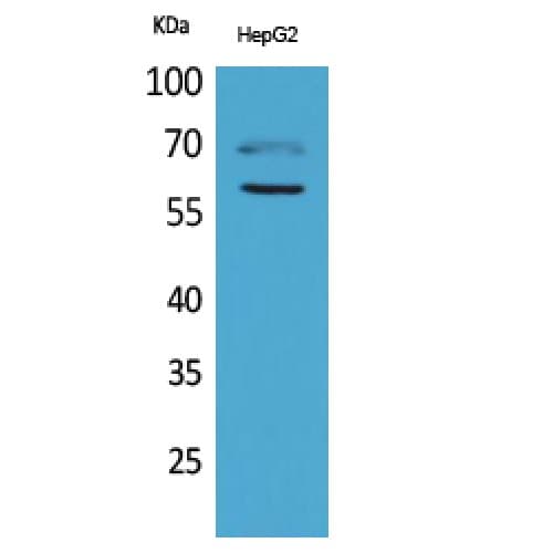 Polyclonal Rabbit anti-Human HEXA Antibody (121-170 aa, Internal, WB)