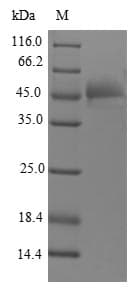 Human FGF12 Protein (Recombinant GST, N-terminus)