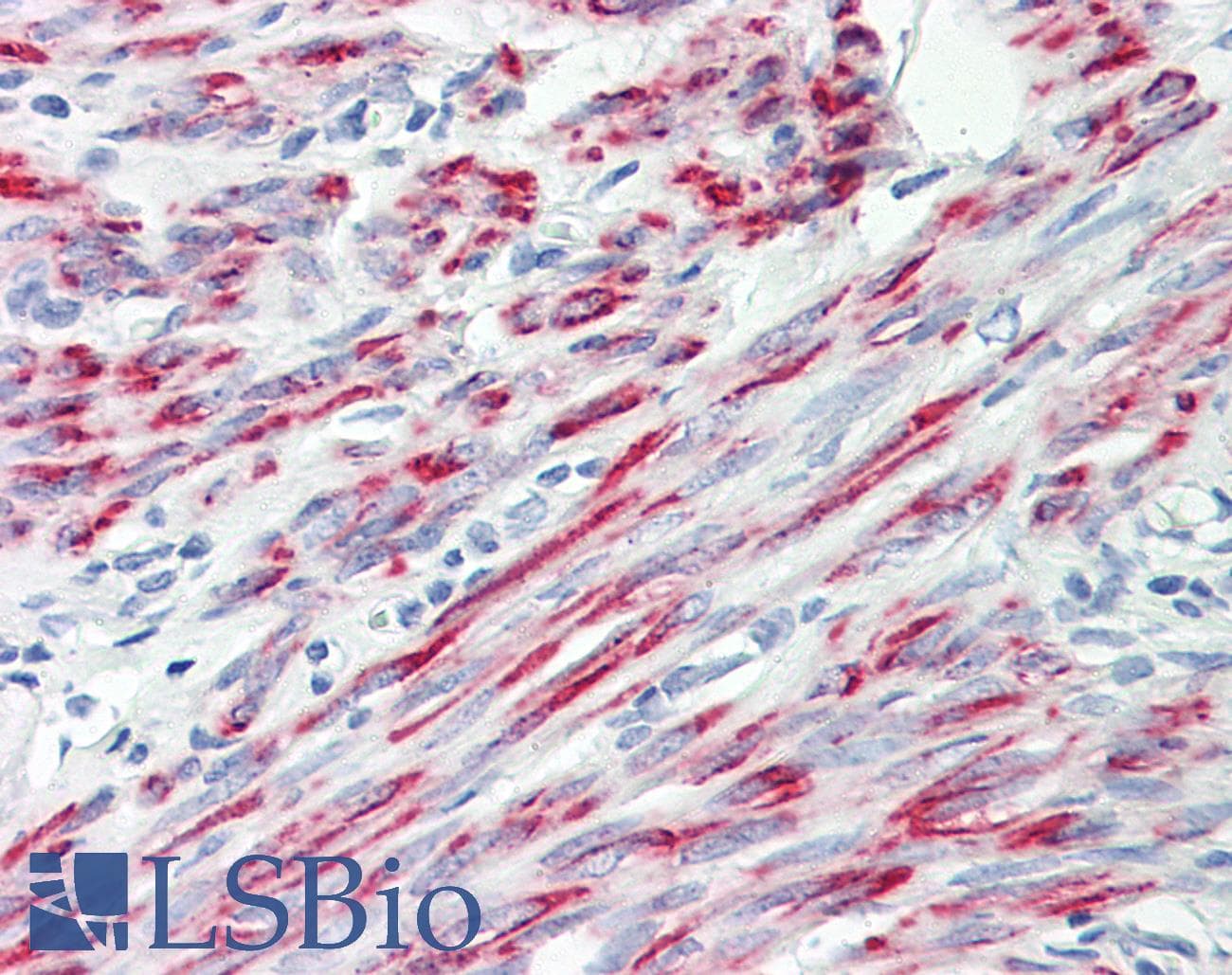CPEB2 Antibody (aa543-592)