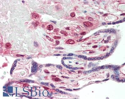 IHC-plus™ Polyclonal Rabbit anti-Human MTDH / Metadherin Antibody (aa75-125, IHC)