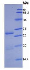 Human DPP4 / CD26 Protein (Recombinant His)