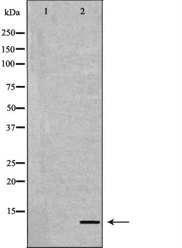 Polyclonal Rabbit anti-Human APOC2 / Apolipoprotein C II Antibody (IHC, WB)