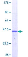 Human CD74 / CLIP Protein (Recombinant GST)