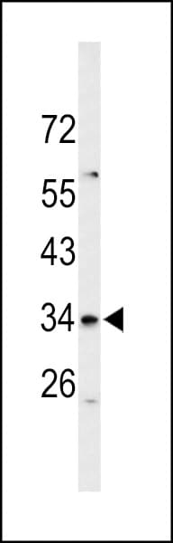 Polyclonal Rabbit anti-Human SLC39A3 / ZIP3 Antibody (aa106-134, IHC, WB)