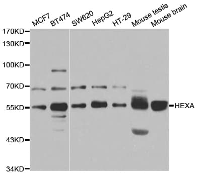 Polyclonal Rabbit anti-Human HEXA Antibody (WB)