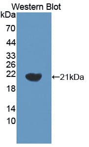 SMARCA3 / HLTF Antibody (aa831-990)