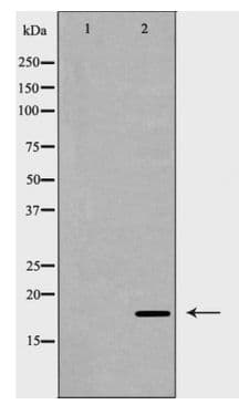 Polyclonal Rabbit anti-Human SOD1 / Cu-Zn SOD Antibody (WB)